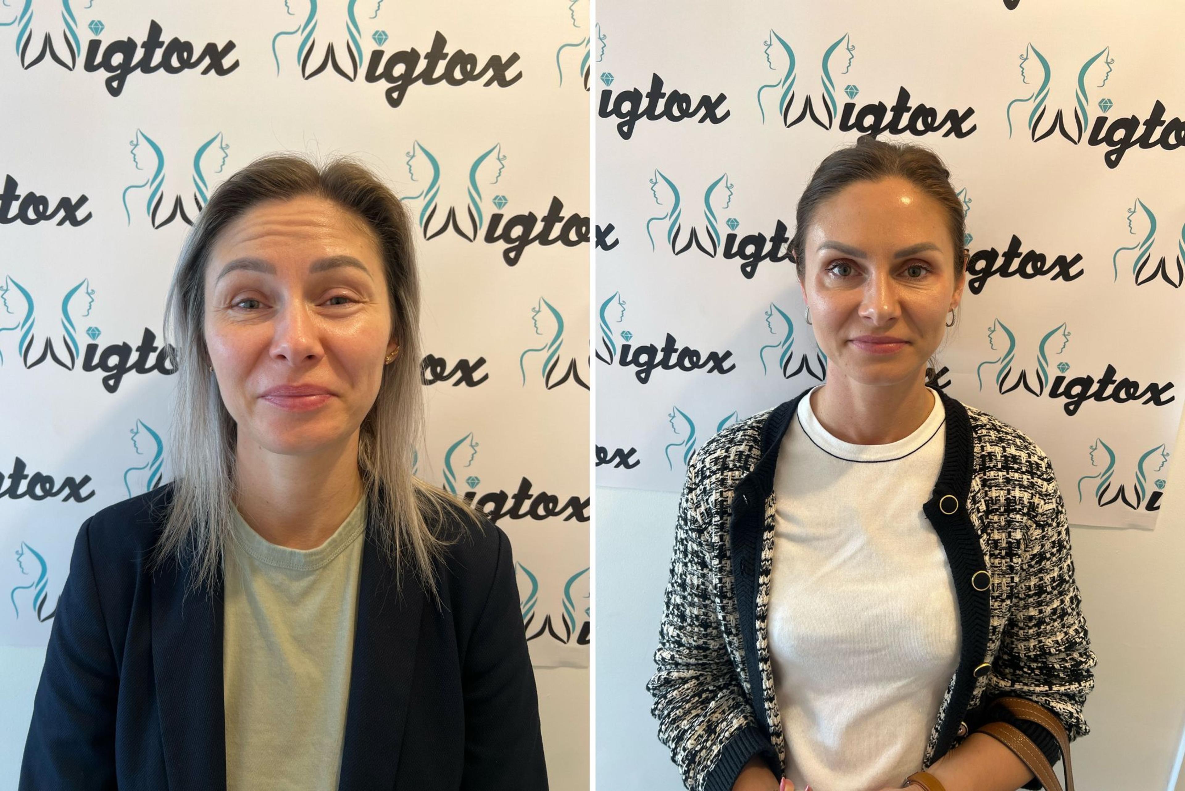 Cover image for No More Lines with Botox Wigtox South Yorkshire