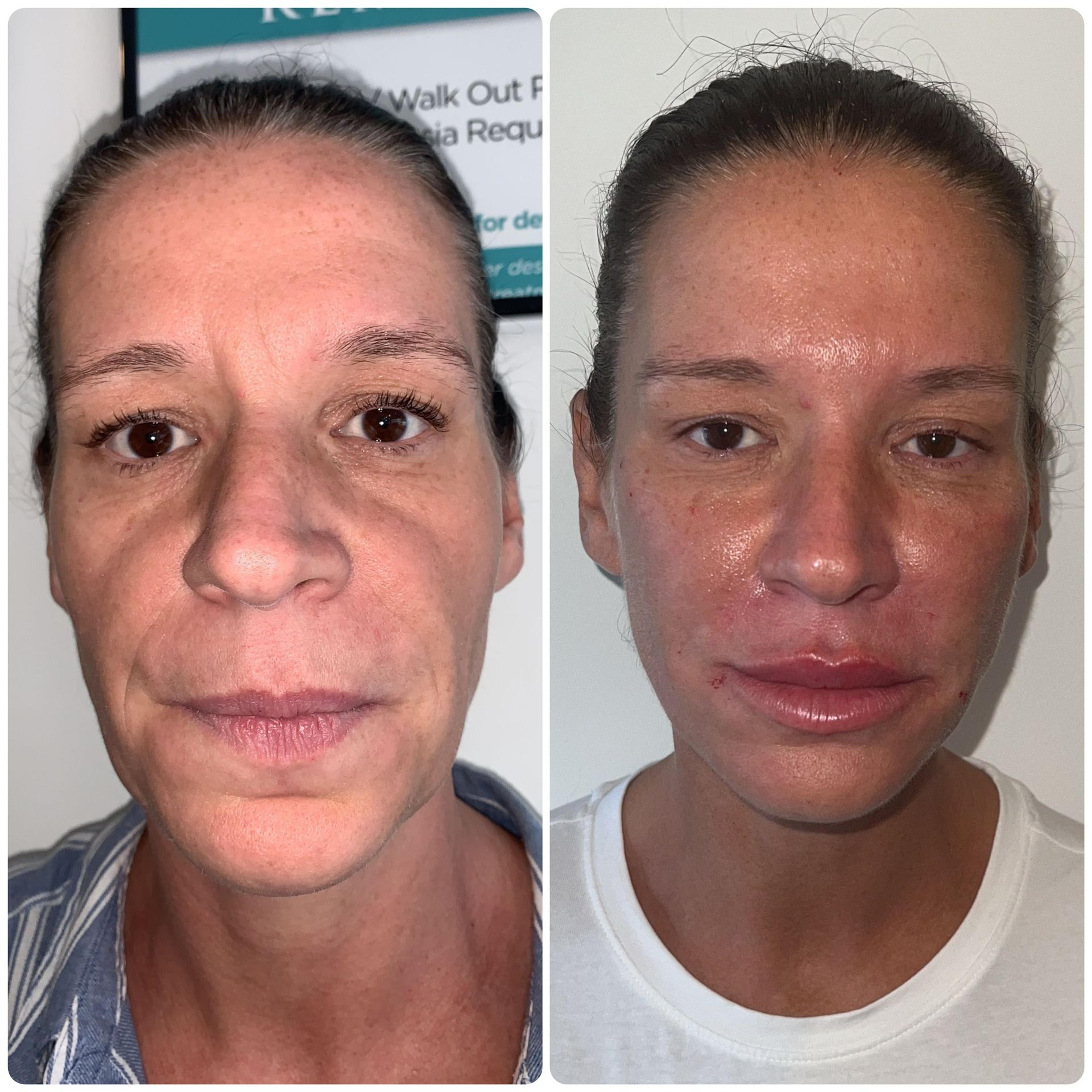 Cover image for Katie’s 10 Years Younger Transformation In Rotherham (1)